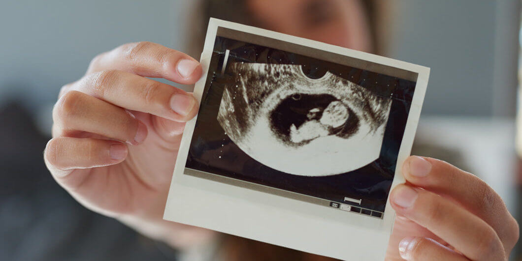 اولین سونوگرافی بارداری